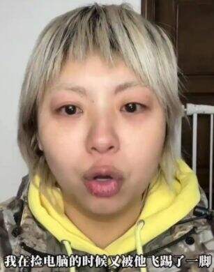 张大大被指暴力殴打他人,“残忍折磨”2个小时,称自己讲话就是圣旨